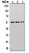 Keratin 14 antibody, LS-C352436, Lifespan Biosciences, Western Blot image 