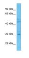 E74 Like ETS Transcription Factor 5 antibody, orb331438, Biorbyt, Western Blot image 