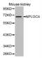 NPL4 Homolog, Ubiquitin Recognition Factor antibody, A08476, Boster Biological Technology, Western Blot image 