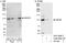 ATP Binding Cassette Subfamily F Member 1 antibody, A301-999A, Bethyl Labs, Immunoprecipitation image 