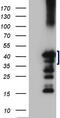 Zinc Finger CCCH-Type Containing 8 antibody, M12985, Boster Biological Technology, Western Blot image 