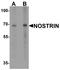 Nitric Oxide Synthase Trafficking antibody, PA5-72837, Invitrogen Antibodies, Western Blot image 