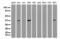 Sequestosome 1 antibody, LS-C796674, Lifespan Biosciences, Western Blot image 