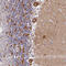 Voltage-dependent anion-selective channel protein 2 antibody, HPA043475, Atlas Antibodies, Immunohistochemistry paraffin image 