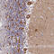 Voltage Dependent Anion Channel 2 antibody, HPA043475, Atlas Antibodies, Immunohistochemistry paraffin image 
