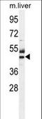 Cytosolic Thiouridylase Subunit 1 antibody, LS-C156677, Lifespan Biosciences, Western Blot image 