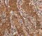 FOS Like 1, AP-1 Transcription Factor Subunit antibody, MBS2518053, MyBioSource, Immunohistochemistry paraffin image 