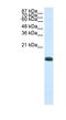 Zinc Finger Protein 786 antibody, NBP1-80405, Novus Biologicals, Western Blot image 