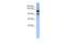 Homeodomain Interacting Protein Kinase 1 antibody, A05247, Boster Biological Technology, Western Blot image 