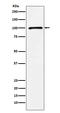 Glutamate Ionotropic Receptor Kainate Type Subunit 2 antibody, M03374, Boster Biological Technology, Western Blot image 