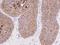 PEM antibody, 12123-R183, Sino Biological, Immunohistochemistry paraffin image 