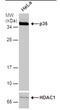 Cyclin Dependent Kinase 5 Regulatory Subunit 1 antibody, PA5-78263, Invitrogen Antibodies, Western Blot image 