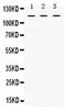 Unc-5 Netrin Receptor C antibody, PB9841, Boster Biological Technology, Western Blot image 