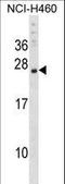 Cysteine And Glycine Rich Protein 3 antibody, LS-C167099, Lifespan Biosciences, Western Blot image 