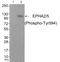 EPH Receptor A2 antibody, AP55847PU-S, Origene, Western Blot image 