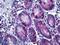 Kinesin Family Member C1 antibody, LS-B5425, Lifespan Biosciences, Immunohistochemistry frozen image 
