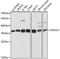 Exosome Component 7 antibody, A11141, Boster Biological Technology, Western Blot image 