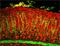 Collagen Type I Alpha 2 Chain antibody, PA1-85319, Invitrogen Antibodies, Immunohistochemistry paraffin image 