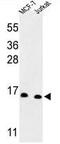 Small Nuclear Ribonucleoprotein D3 Polypeptide antibody, GTX80441, GeneTex, Western Blot image 