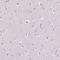 Rhodopsin antibody, NBP2-55553, Novus Biologicals, Immunohistochemistry frozen image 