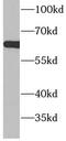 Acyl-CoA Synthetase Medium Chain Family Member 5 antibody, FNab00112, FineTest, Western Blot image 