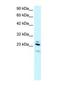 Regulator Of G Protein Signaling 20 antibody, NBP1-54885, Novus Biologicals, Western Blot image 