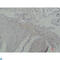 Galectin 3 antibody, LS-C812351, Lifespan Biosciences, Immunohistochemistry paraffin image 