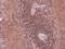 Rho/Rac Guanine Nucleotide Exchange Factor 18 antibody, GTX102223, GeneTex, Immunohistochemistry paraffin image 