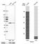 Tropomodulin-3 antibody, HPA001849, Atlas Antibodies, Western Blot image 