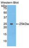 Transportin-1 antibody, LS-C296783, Lifespan Biosciences, Western Blot image 