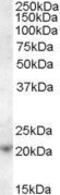 Anti-Silencing Function 1A Histone Chaperone antibody, GTX88909, GeneTex, Western Blot image 