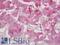 Forkhead Box L2 antibody, 45-617, ProSci, Immunohistochemistry frozen image 