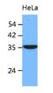 Inhibitor Of Growth Family Member 2 antibody, GTX53732, GeneTex, Western Blot image 