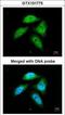 C-Terminal Binding Protein 1 antibody, GTX101775, GeneTex, Immunofluorescence image 