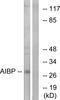 NAD(P)HX Epimerase antibody, LS-C119731, Lifespan Biosciences, Western Blot image 