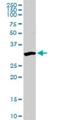 Protein Phosphatase 1 Regulatory Subunit 3C antibody, H00005507-D03P, Novus Biologicals, Western Blot image 