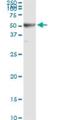 Ribonucleotide Reductase Regulatory Subunit M2 antibody, H00006241-M01, Novus Biologicals, Immunoprecipitation image 