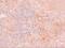 Jumonji Domain Containing 4 antibody, GTX85252, GeneTex, Immunohistochemistry paraffin image 