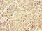CWC22 Spliceosome Associated Protein Homolog antibody, LS-C677624, Lifespan Biosciences, Immunohistochemistry paraffin image 