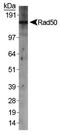 RAD50 Double Strand Break Repair Protein antibody, NB100-154, Novus Biologicals, Western Blot image 