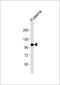 Complement Factor B antibody, GTX80605, GeneTex, Western Blot image 