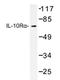 Interleukin 10 Receptor Subunit Alpha antibody, AP20308PU-N, Origene, Western Blot image 