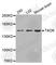 TAO Kinase 2 antibody, A3353, ABclonal Technology, Western Blot image 