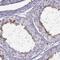 TBC1 domain family member 3 antibody, NBP2-46751, Novus Biologicals, Immunohistochemistry paraffin image 