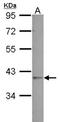 Galactose Mutarotase antibody, NBP2-16592, Novus Biologicals, Western Blot image 