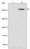 Mechanistic Target Of Rapamycin Kinase antibody, P00003-1, Boster Biological Technology, Western Blot image 