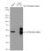 Interleukin 3 Receptor Subunit Alpha antibody, NBP2-16953, Novus Biologicals, Western Blot image 