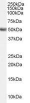 Fatty Acid Desaturase 1 antibody, GTX89153, GeneTex, Western Blot image 