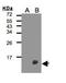 TYRO Protein Tyrosine Kinase Binding Protein antibody, NBP2-16099, Novus Biologicals, Western Blot image 