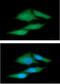 Proteasome Activator Subunit 1 antibody, GTX57620, GeneTex, Immunofluorescence image 